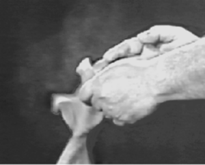 Figure 1. Dust produced by removing a latex glove containing powder