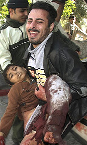 一名加沙受伤儿童被送到医院