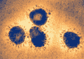 image of coronavirus