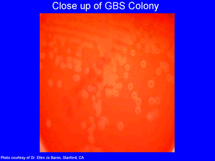 Close up GBS Colony