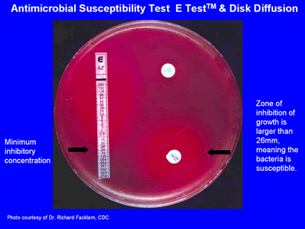 Antimicrobial Susceptibility Test E Test & Disk Diffusion