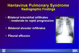 Slide 16: HPS Radiographic Findings