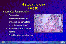Slide 23: Histopathology  Lung (1)
