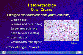 Slide 25: Histopathology Other Organs