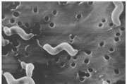 bacteria responsible for campylobacteriosis