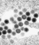 RVF virus electron micrograph