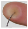 photo of a needle deeply penetrating a fingertip