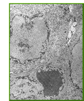 Image of Saint Louis Encephalitis as seen under a microscope