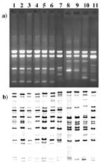 Figure. A) RAPD patterns of Corynebacterium diphtheriae isolated from 1995 to 1997. Lane 1, 1740 (strain #), gravis, G1/4 RAPD type strain. Lane 2, B327, gravis, G1/4 (RAPD type), 1997 (year of isolation). Lane 3, B400, mitis, G1/4, 1995. Lane 4, 490, gravis, G1/4 ribotyping type strain. Lane 5, B375, gravis, G1/4, 1995. Lane 6, B294, mitis, G1/4, 1996. Lane 7, B325, gravis, G4v, 1997. Lane 8, 860, mitis, M1/M1v RAPD type strain. Lane 9, B389, mitis, M1/M1v, 1995. Lane 10, B324, mitis, M1/M1v, 1997. Lane 11, B306, mitis, new RAPD pattern, 1997. B) Ribotyping patterns of C. diphtheriae isolated from 1995-1997. Lane 1, G4174 (strain #), gravis, G1 ribotyping type strain. Lane 2, B327, gravis, G1 (ribotype) 1997 (year of isolation). Lane 3, B400, mitis, G1, 1995. Lane 4, G4183, gravis, G4 ribotyping type strain. Lane 5, B375, gravis, G4, 1995. Lane 6, B294, mitis, G4, 1996. Lane 7, B325, gravis, G4v, 1997. Lane 8, G4212, mitis, M1 ribotyping type strain. Lane 9, B389, mitis, M1, 1995. Lane 10, B324, mitis, M1v, 1997. Lane 11, B306, mitis, new ribotype, 1997.