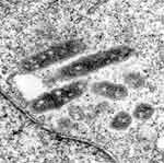 Figure 1. Transmission electron micrograph of the ELB agent in XTC-2 cells. The rickettsia are free in the cytoplasm and surrounded by an electron transparent halo. Original magnification X 30,000.