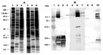 Figure 3. (A) Silver-stained SDS-PAGE of whole-cell protein preparations of Rickettsia conorii, the ELB agent and R. typhi. Lane 1, R. conorii; lane 2. ELB agent; lane 3, R. typhi; lane 4, heated R. conorii; lane 5, heated ELB agent; lane 6, heated R. typhi. Molecular weights are indicated on the left. (B) Western blot of rickettsial proteins probed with various antisera. R. conorii antigens (lanes 2, 6, and 10), ELB agent antigens (lanes 3, 7, and 11) and R. typhi antigens (lanes 4, 8, and 12) were probed with anti-R. conorii (lanes 2 to 4), anti-ELB agent (lanes 5 to 7) and anti-R. typhi (lanes 8 to 10) polyvalent mouse antisera. Lane 1: molecular weight marker.