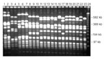 Figure. Pulsed-field gel electrophoresis (PFGE) profiles of Staphylococcus aureus isolates digested with Sma 1. A variety of PFGE profiles are demonstrated in these 23 isolates.