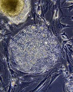 Micrograph of pluripotent cells.