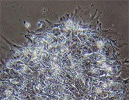 These human embryonic stem cells are “blank slate” cells that can differentiate into any of the 220 cell types in the human body.