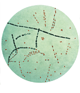 image: photo of Bacillus anthracis, the microorganism that causes anthrax