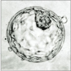 Human Blastocyst Showing Inner Cell Mass and Trophectoderm
