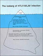 Because AIDS symptoms can take 10 years to develop, only a small fraction of the epidemic was visible in 1985