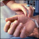Healthcare worker takes a patient's pulse