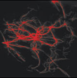 photo of actin filaments