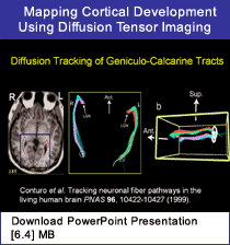 Link - Powerpoint presentation: Mapping Cortical Development Using Diffusion Tensor Imaging