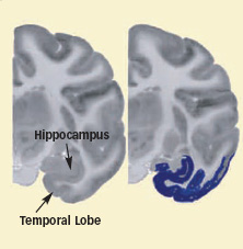 Graphic of temporal lobe exposed activity in monkey brains