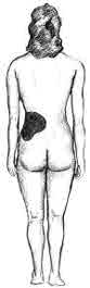 Image of back side of a person with side of waist shaded.