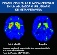 Decreased Brain Function in Methamphetamine Ambuser image