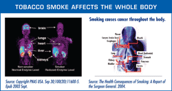 Tobacco Smoke Affects the Whole Body image