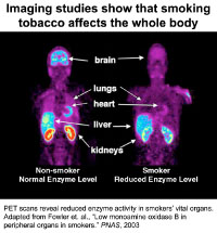 Imaging studies show that smoking tobacco affects the whole body image