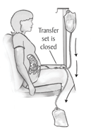 After the used solution is removed from your abdomen, you will close or clamp the transfer set and let some of the fresh solution flow directly into the drain bag.  This flushing step removes air from the tubes.