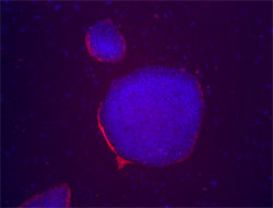 SSEA-1 stain image of cell line WA01