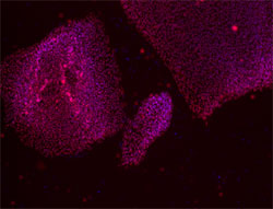 Oct-4 stain image of cell line UC06(1)