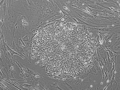 Phase image of cell line TE03