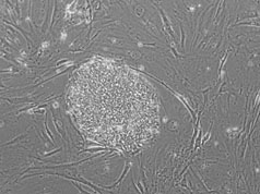Phase image of cell line TE06