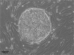 Phase image of cell line UC06