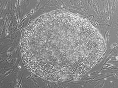 Phase image of cell line WA13