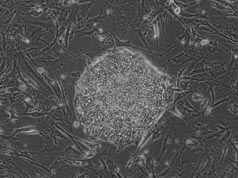 Phase image of cell line ES06