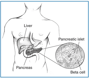 Drawing of a body torso showing the location of the liver and the pancreas with an enlargement of a pancreatic islet containing beta cells.