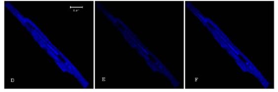 ED-FRAP and Intact Cardiac Myocytes