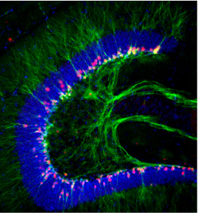Hippocampus Dentate Gyrus Neural Stem Cells