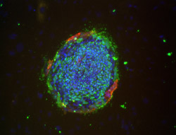SSEA1/SSEA4 stain image of cell line ES03