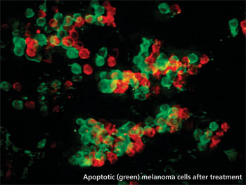 apoptic melanoma cells, post-treatment