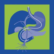 Conference artwork depicting the digestive system, biliary tree and other ducts. 