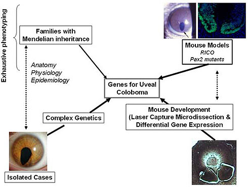 Our clinical studies are focused on understanding how patients with coloboma see and what, if any, associated clinical conditions they might have.  Using state-of-the-art diagnostic equipment, we are trying to better understand the anatomy of eyes and the visual pathways of patients with coloboma.  We are also collecting detailed clinical and epidemiology information.