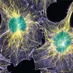 This image, taken with a microscope-camera, shows the intricate network of fibers that builds a cell's structure. These fibers are called microtubules (yellow) and actin filaments (blue). Clare Waterman-Storer