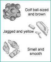 Illustration of different kinds of kidney stones: golf ball-sized and brown, jagged and yellow, small and smooth