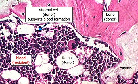 A single bone marrow stromal stem can reform a bone/marrow organ.