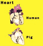 Human and pig parts are similar, but not identical. But for transplants, the fit may be close enough.