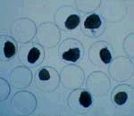 Islet cell masses encapsulated in a protective polymer. Courtesy Dr. P. de Vos., Groningen U.