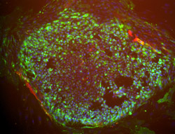 SSEA1/SSEA4 stain image of cell line TE06